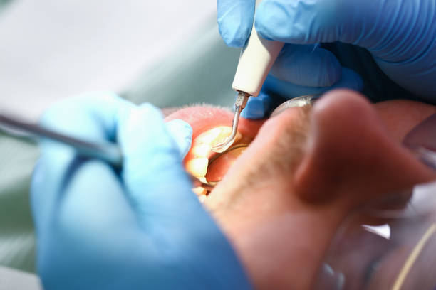 Emergency Gum Pain Relief in WA